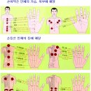 수지침 이미지