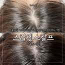 [서울 노원] 헤어라인 고민 끝! '스칼렌스칼프 노원점' 1회차부터 3회차까지 리얼 후기