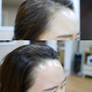한채영헤어라인 | 부천왁싱 : 왁싱팩토리에서 헤어라인 정리했어요!