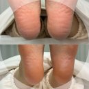 아이컬리티(EYE Curlity) | 태릉입구패디플래닝 아이컬리티 태릉입구점 : 굳은살 정리 잘하는 공릉발각질제거 전문샵