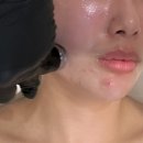 엘리유스킨 이미지