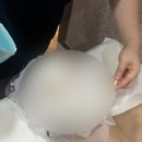 여산빌딩 앞 | 얼굴선이 바뀌니까, 표정도 달라졌어요 역삼역 얼굴비대칭 교정 받고 느낀 리얼 후기