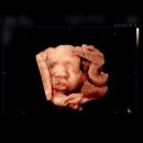 강서구보건소 | 부산 강서구보건소 백일해 예방접종 후기ㅣ 가격·시간·보건소 근처 현지인 맛집까지 총정리