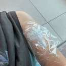 수포차 | 김해 타투 레이저 제거 내돈내산 2회차 후기