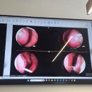 서울한의원 | 서울 비염 성지 라경찬 한의원 후기｜비염 5단계 진단 후 관리 시작과 치료 방향 기록