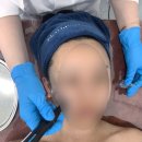 순에스테틱 | 창원 에스테틱 창원피부관리 꼼꼼하게 잘하는 곳 : 순...피부 상태 판독 후 받은 슈퍼젝션 관리 솔직 후기