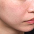 흥도초등학교 | 덕양구피부과 세르프 600샷 후기｜레디어스·물광톡스 받고 정착한 이유