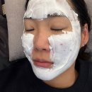 노원역피부과추천 스킨보톡스 잘하는 곳 일주일차후기