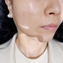 집에서 만나는 전문가급 물방울 초음파기기, 소노엘 한 달 홈케어 솔직 후기