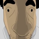 서구-4 | [광주 서구] 내돈내산 턱 보톡스 4일 차 후기💸