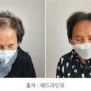헤드라인유 이미지