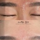 비엘에스테틱 네이버블로그