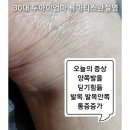 류마변세진내과의원 네이버블로그