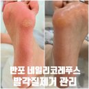 네일리코레푸스 이미지