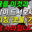 감기 가래 생기는 이유 누런콧물 가래 삭히는 음식 이미지