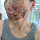 비우고채움 | 모공 비우고 탄력 채우는 2STEP 루틴! 티크 워시오프팩 &amp; 카페인 탄력크림으로 완성하는 홈케어