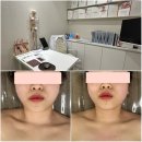 엘가네 | 안양신부관리 윤곽 후기, 찐 전문가 1인샵 엘가비에스테틱❤️