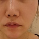 센텀3로 | 부산 수영구 피부과 센텀 피부과 써마지 300샷 후기