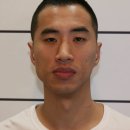 턱비대칭 보톡스, 교정기 이것저것 다 해본 결론