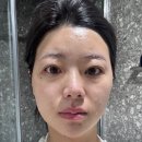 공덕제일약국 | [서울/공덕] 페이스피부과 리쥬란힐러, 울쎄라, 마포 피부과 잘하는곳, 울쎄라 잘하는 곳, 수면마취...