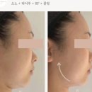 옴 에스테틱