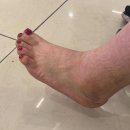 단원구청 삼거리 5 | 안산 고잔동 박진영 병원 발목인대 수술후기 (feat.단원구청민원접수)불량보도블럭 도로교통과