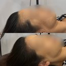 햅번헤어 - 남양주시 | 창원 헤어라인 잘하는 곳, M자 숱채움, 상남동 오드리햅번 다녀온 후기
