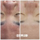 예신들이 준비해야 할 웨딩케어 작은얼굴,물광피부,기린목,쇄골 3개월 동안 해결하자