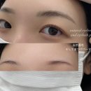 오구브로우 이미지