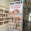 내성적인;네일&닥터아이티엔