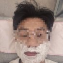 샤인빔의원 | [제모] 아포지엘리트 플러스 제모 10회차 후기, 창원샤인빔의원