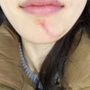 함희정성형외과의원 네이버블로그