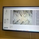 금강벤처텔 | 안양 두피케어 모애르두피탈모 범계점 두피 스케일링 집중케어 후기