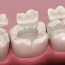 퍼즐치과기공소 이미지