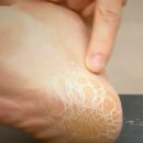 딱풀통신 이미지