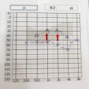 선도동 주민센터 | 경주포낙보청기, 어르신에게 보청기 무료 기증