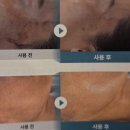 르네셀피부샵 | [대구남구피부관리]씨큐브포뮬라 필로 각질ㆍ모공ㆍ블렉헤드 싹 정돈!예약문의급증