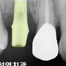 범석영치과 이미지