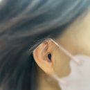 사상독일보청기 이미지