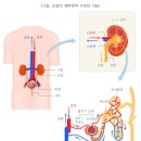 혈액투석이란? 이미지