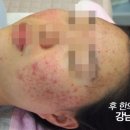 가보자한의원 이미지