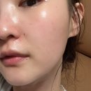 오현1제 | 엑소머 엑소좀스킨부스터앰플 솔직후기