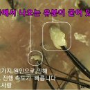 두피탈모태후사랑 이미지