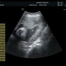 남구청 민원실 | 울산 남구청 혼인신고 후기 보람병원 정기검진