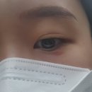 수유우태하피부과