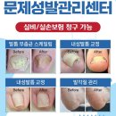 미니스톱 동두천운동장점 | 💅 동두천 발톱무좀 발각질 심했던 30대 여성, 한강연세병원에서 마이코시스레이저로 치료 중!