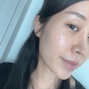 압구정피부과에서 신상 스킨부스터 하이로라 후기!속건조 고민 끝낸 봄비주사