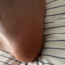 메디칼약국 | 발각질제거 4일 루틴 성공! 화인메디칼 발패치로 발뒤꿈치각질제거 매끈해진 후기💛