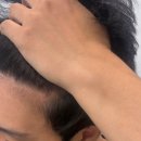 모디헤어플란트의원 이미지