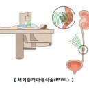 요로결석과 투병일기